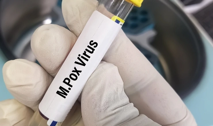 Majmunske boginje više nisu međunarodna zdravstvena kriza