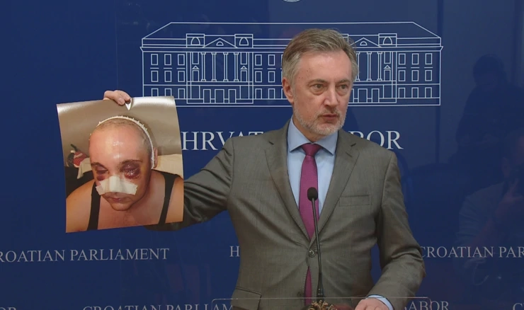 Škoro održao konferenciju povodom incidenta