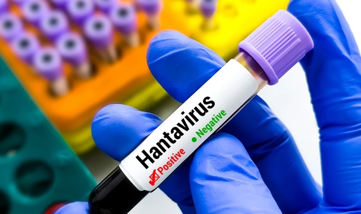 Četvero testiranih u Italiji na hantavirus negativno
