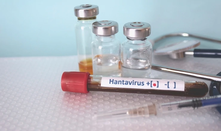 Hantavirus