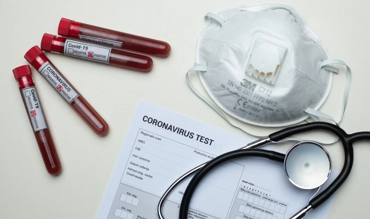 Testiranje na koronavirus 