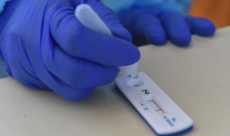 Antigenski test za koronavirus