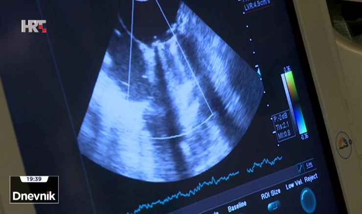 U samo devet dana u KBC-u Zagreb obavljeno čak devet transplantacija