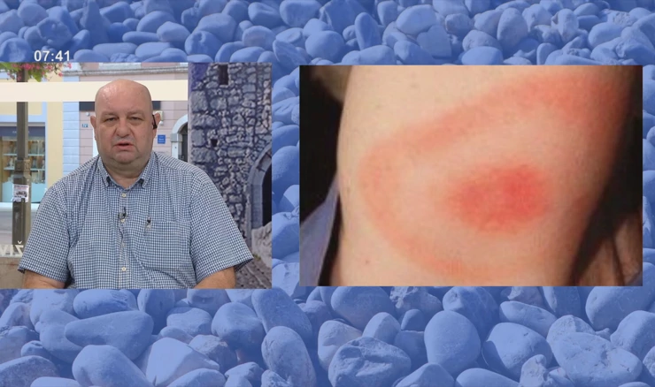 Ubod krpelja