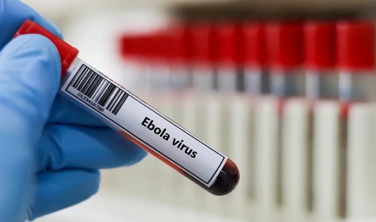 Ebola test