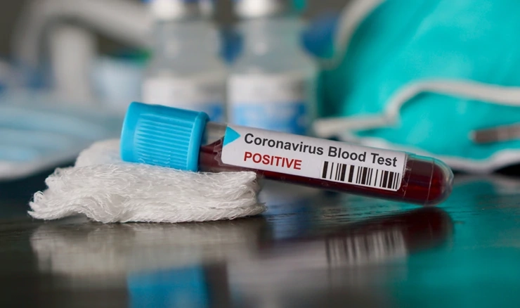 Slovenija opet s rastom epidemije