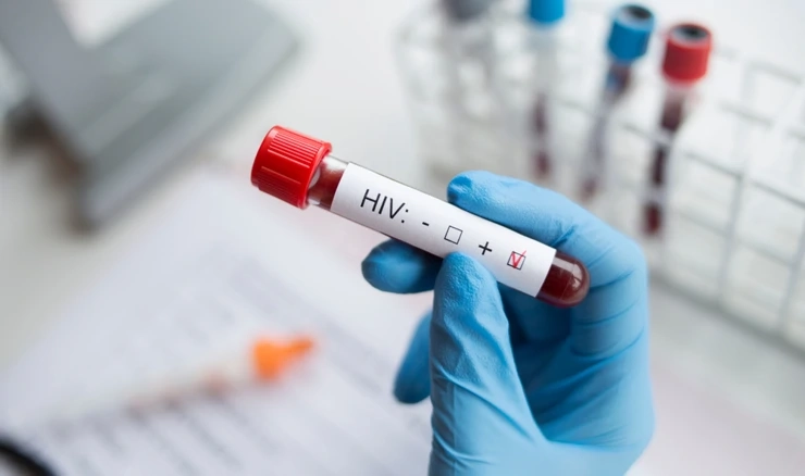 Pandemija i HIV