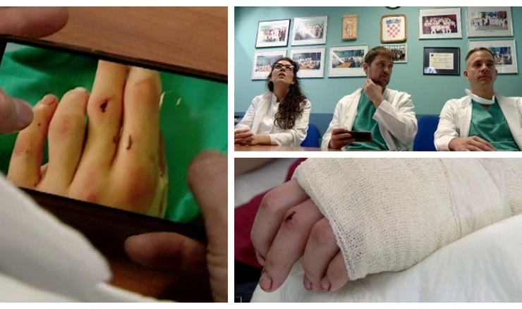 Liječnici KB-a Dubrava mladiću spasili odrezanu šaku