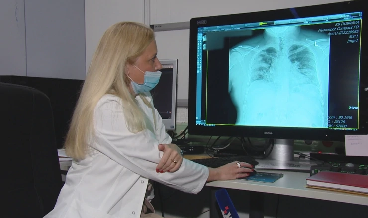Necijepljeni s težom kliničkom slikom