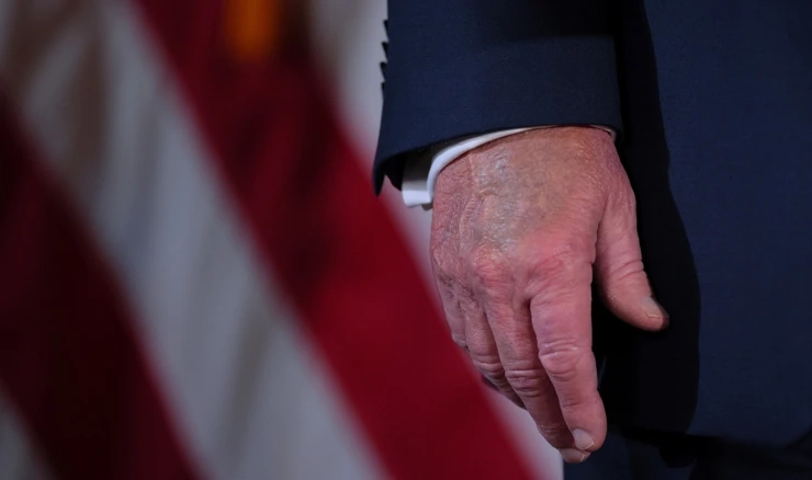 Modrica na Trumpovoj ruci